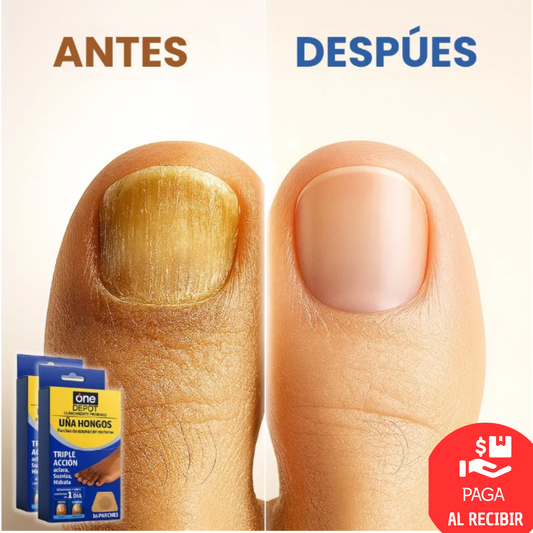 Pack 32 Parches Antihongos – Elimina el Hongo – Uñas Visiblemente Saludables en 7 Días