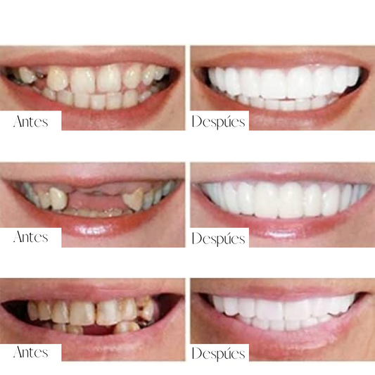 DentaBella™ – Tu nueva sonrisa en solo un clic